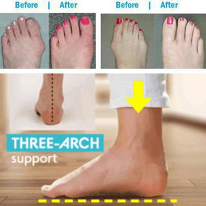 Orthopedic Toe Corrector Bunion Foot Sandals