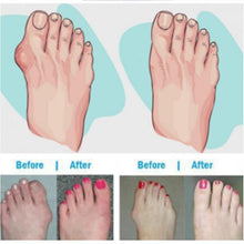 Load image into Gallery viewer, Orthopedic Toe Corrector Bunion Foot Sandals