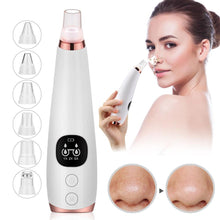 Load image into Gallery viewer, Blackhead Remover Vacuum